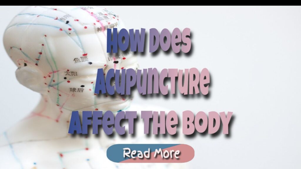 acupuncture